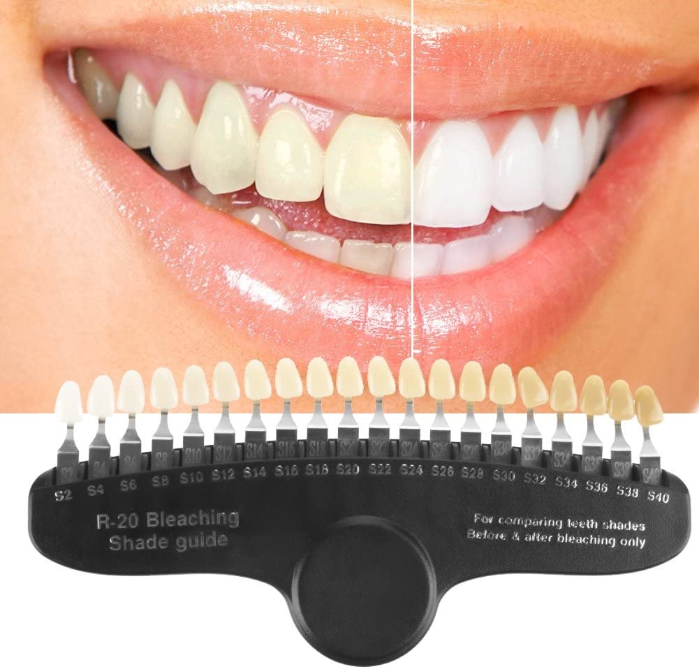 Nuancier de blanchiment des dents en porcelaine